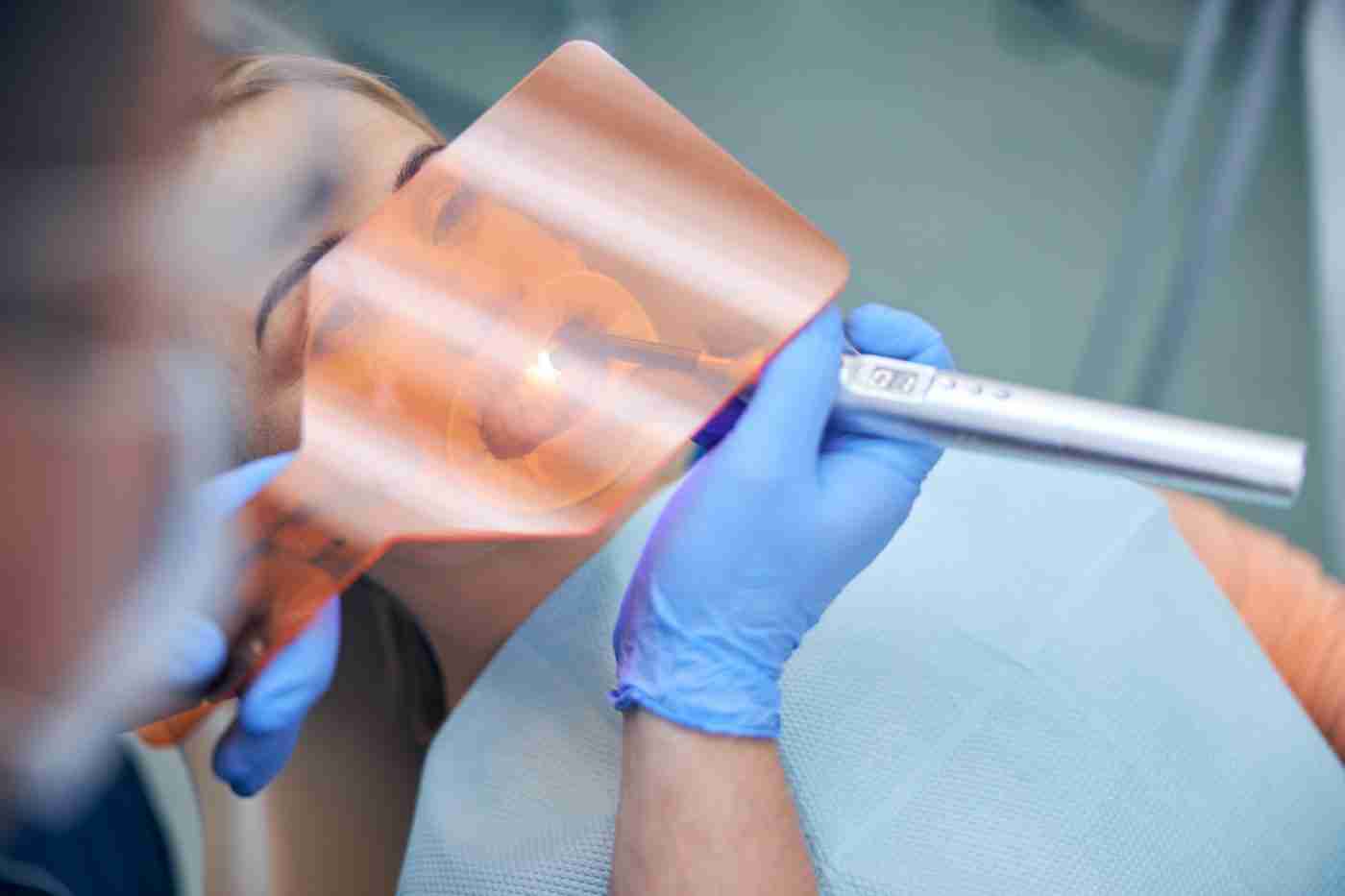 Curing light hardening a tooth-colored dental filling