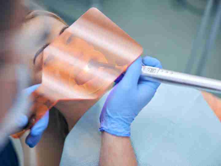 Curing light hardening a tooth-colored dental filling
