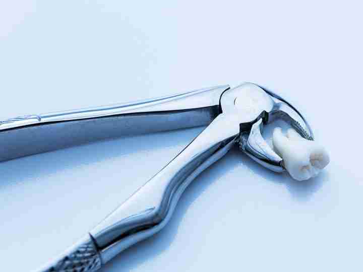 Dental extraction forceps used in oral surgery