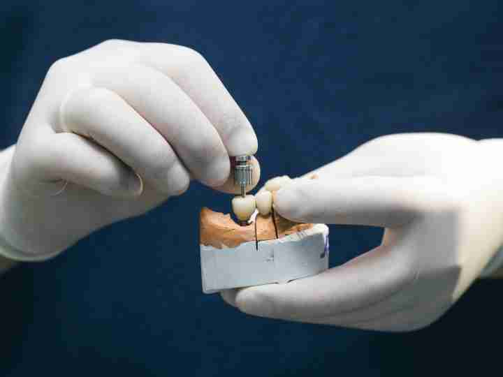 Dentist holding a model with implant-supported restorations
