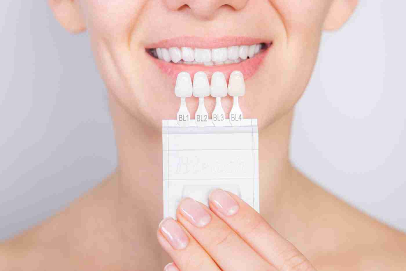 Teeth whitening shade guide held against a bright smile