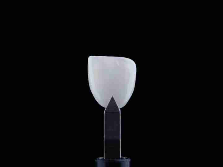 Ultra-thin porcelain veneer held with tweezers