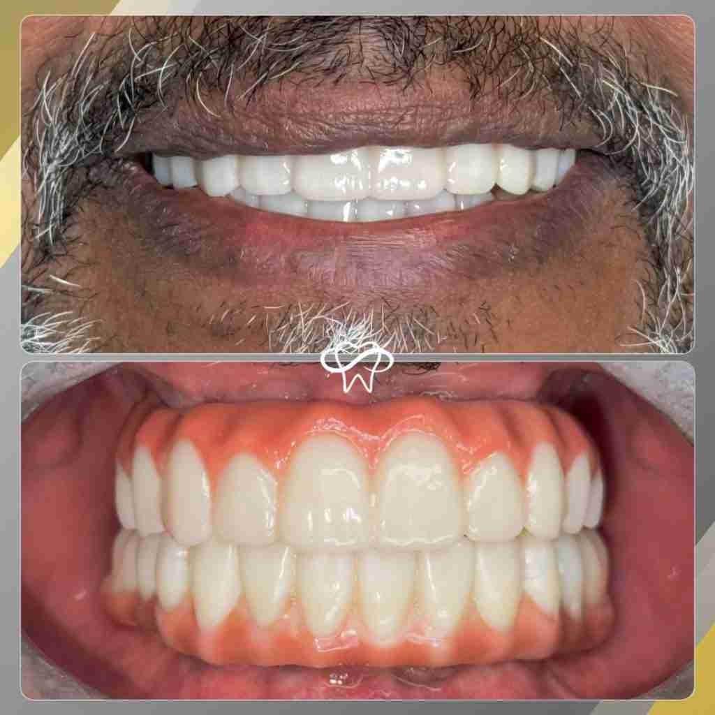 Before and After Dental