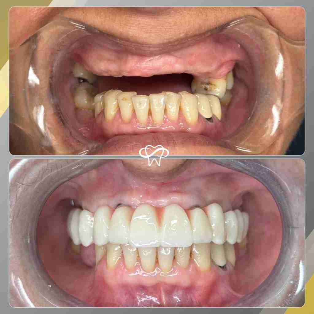 Before and After Dental