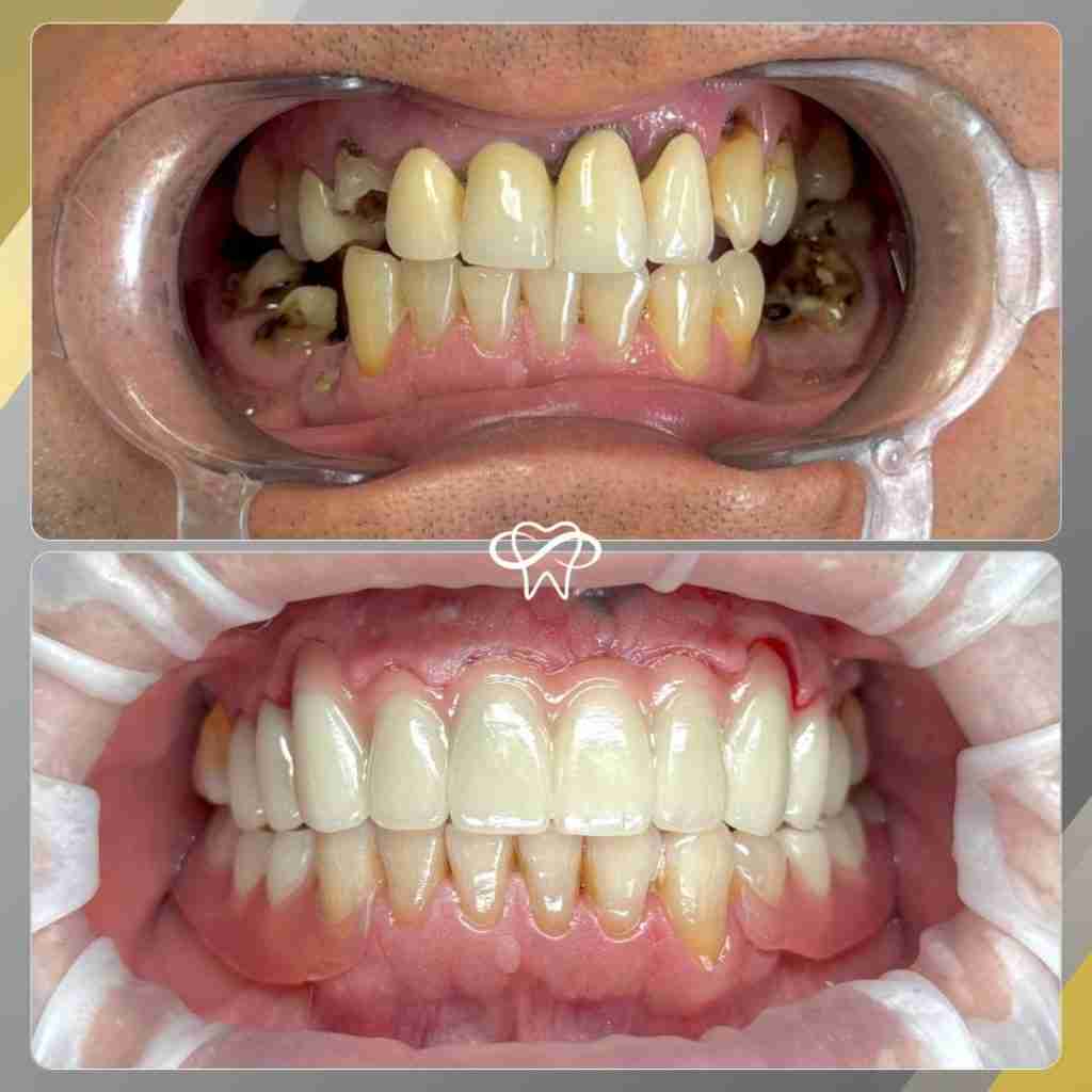 Before and After Dental