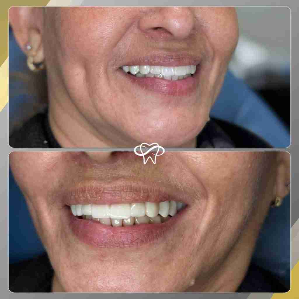 Before and After Dental