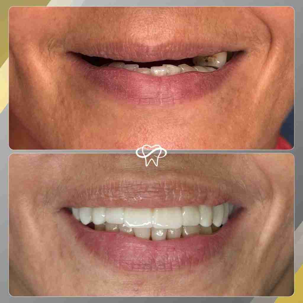 Before and After Dental