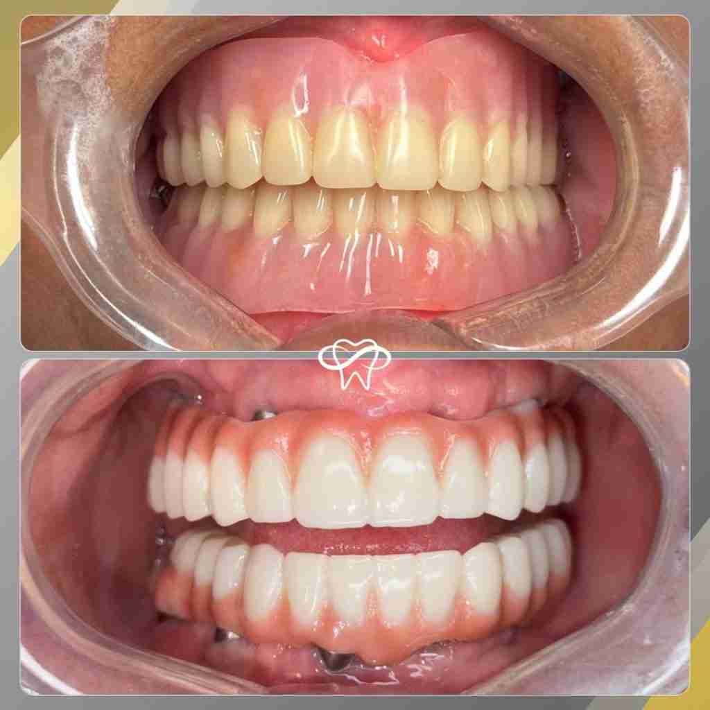 Before and After Dental