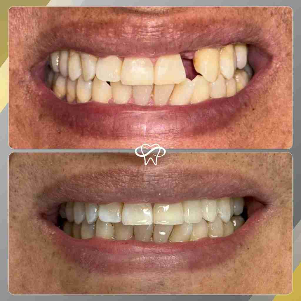 Before and After Dental