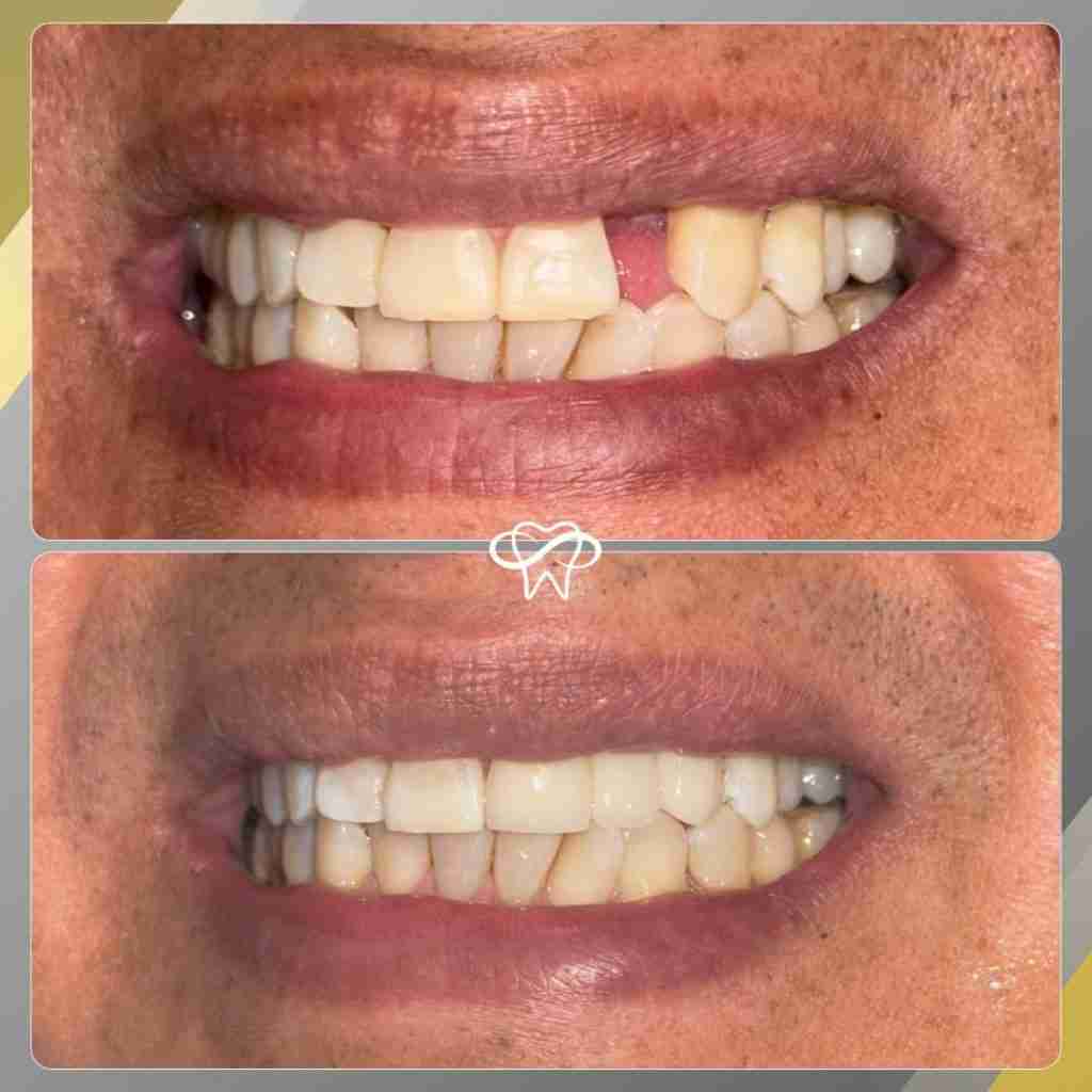 Before and After Dental