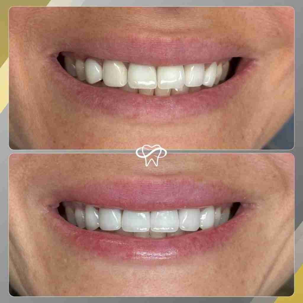 Before and After Dental