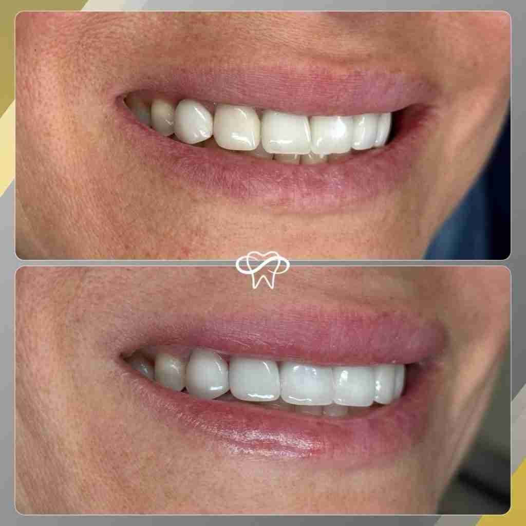 Before and After Dental