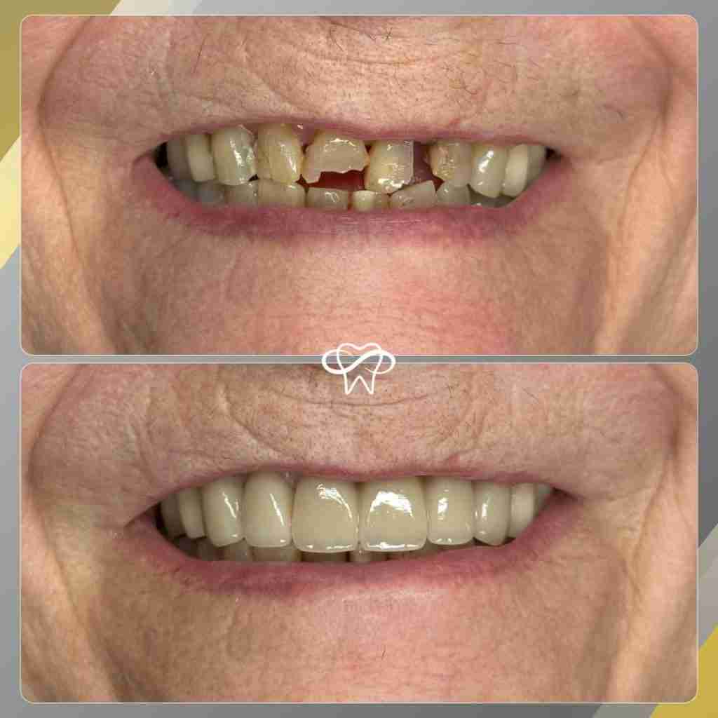 Before and After Dental