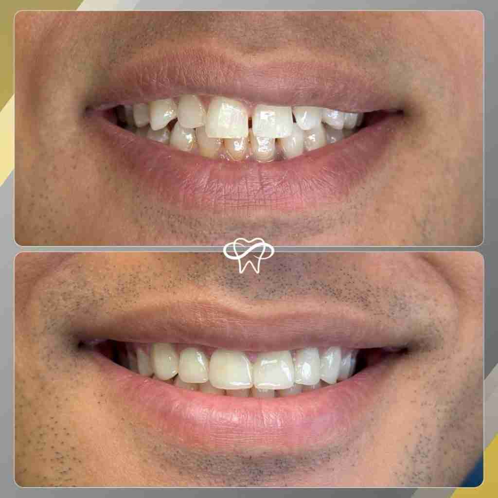 Before and After Dental