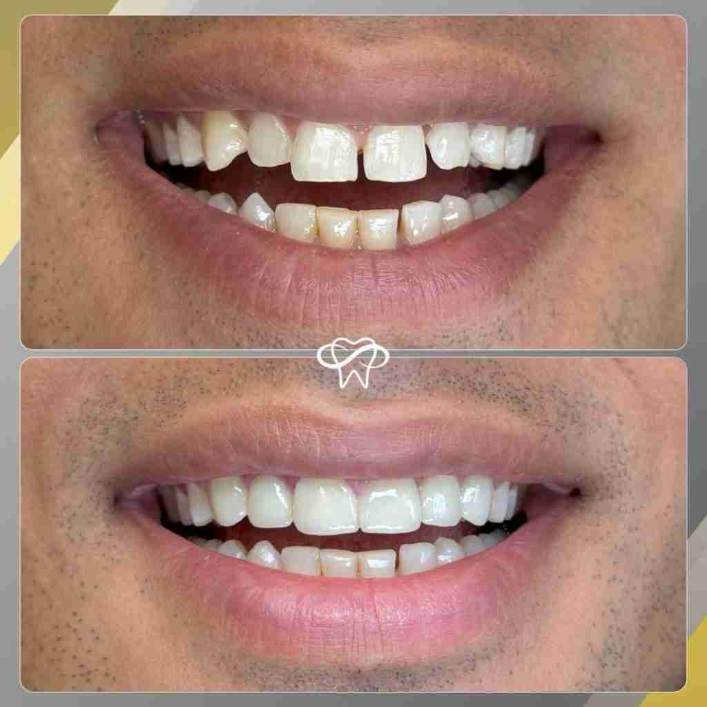 Before and After Dental