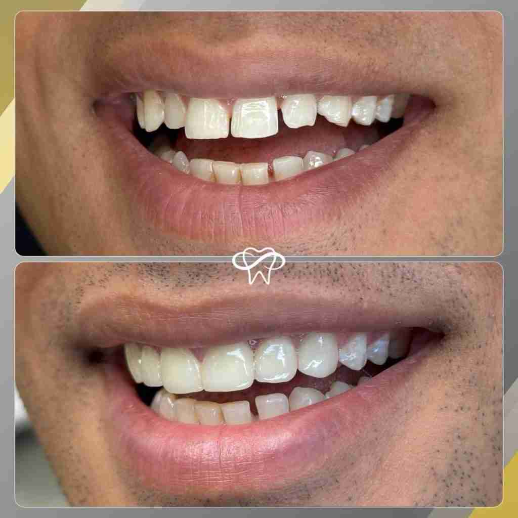 Before and After Dental