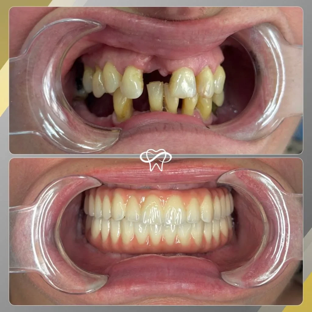 Before and After Dental