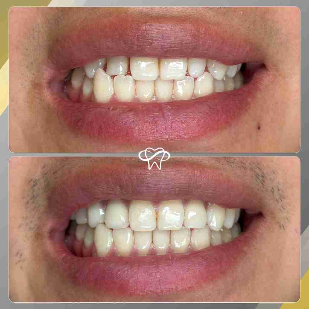 Before and After Dental