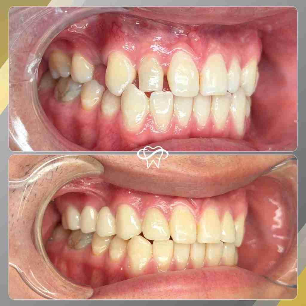Before and After Dental