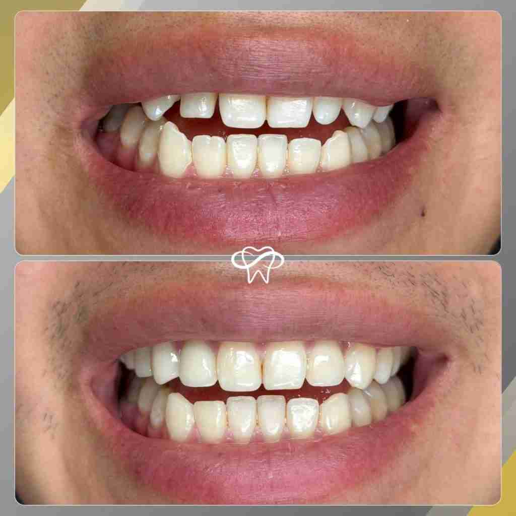 Before and After Dental