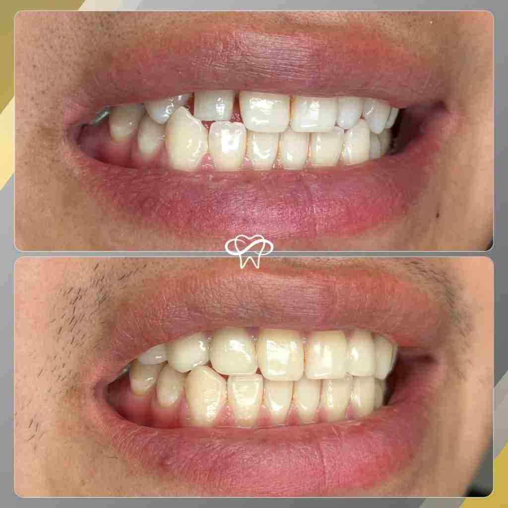 Before and After Dental