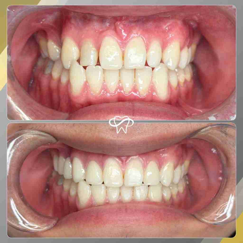 Before and After Dental