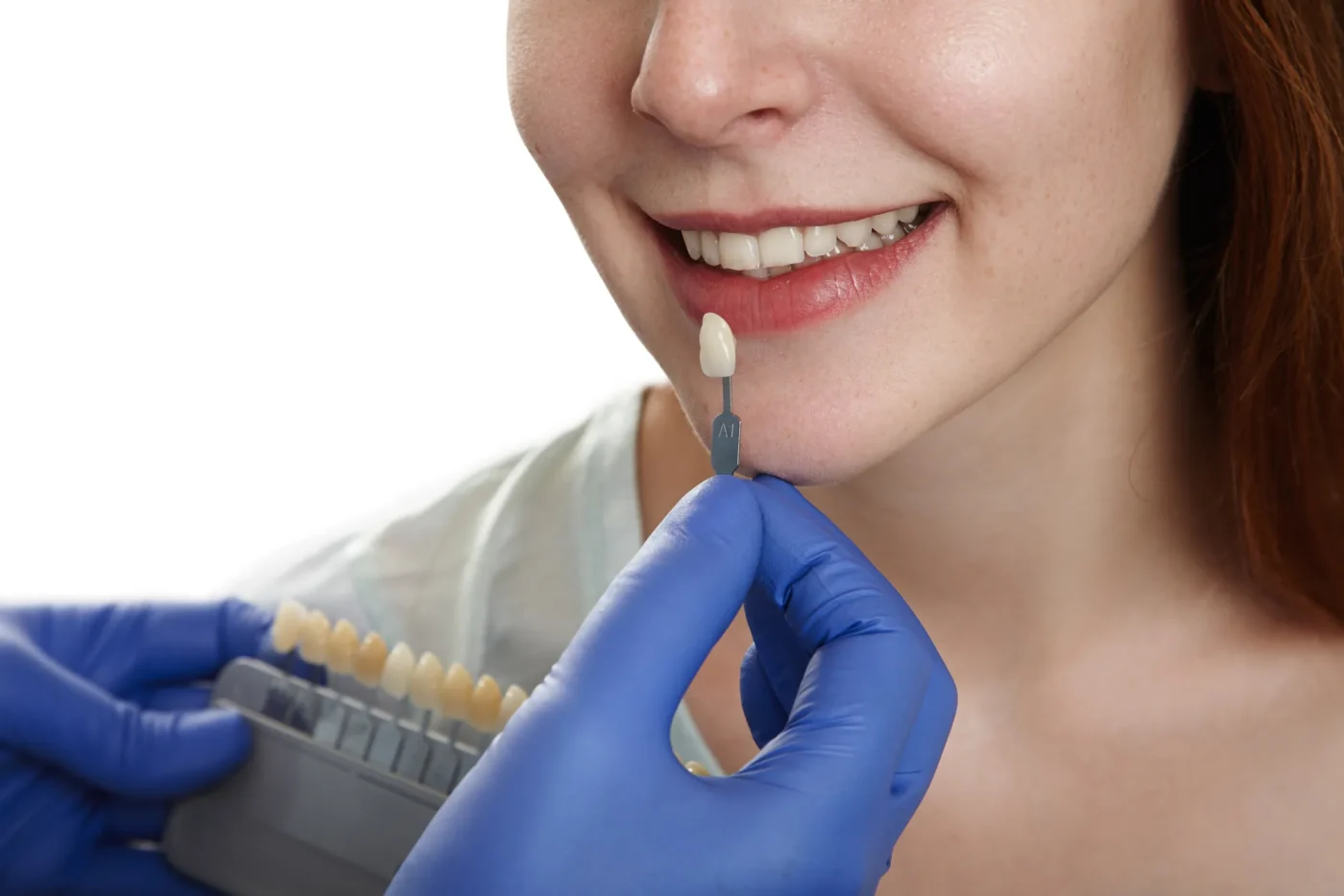 Tooth shade guide held next to a smiling patient's teeth for cosmetic dentistry in Flushing, NY