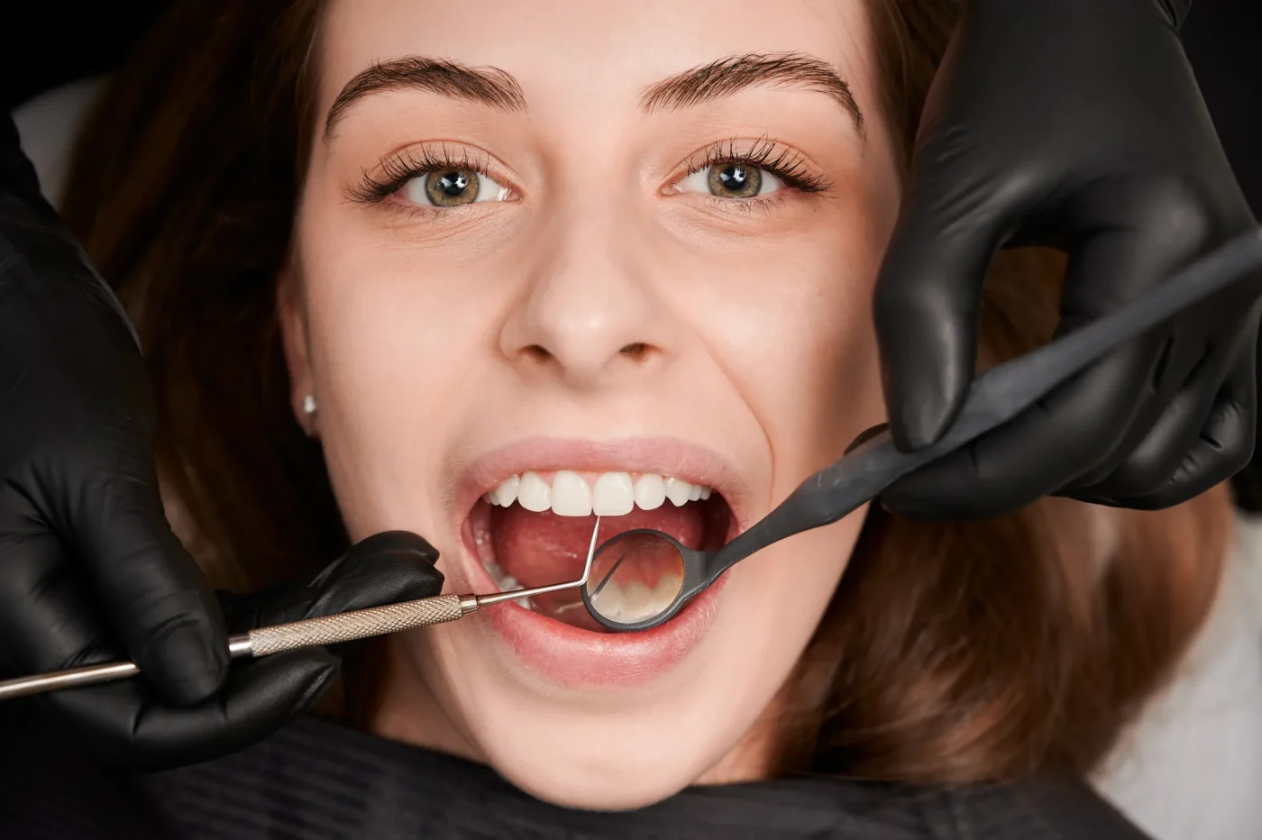 Close-up of a dental exam with a mirror and probe before restorative treatment at Infinity Smiles in Flushing, NY