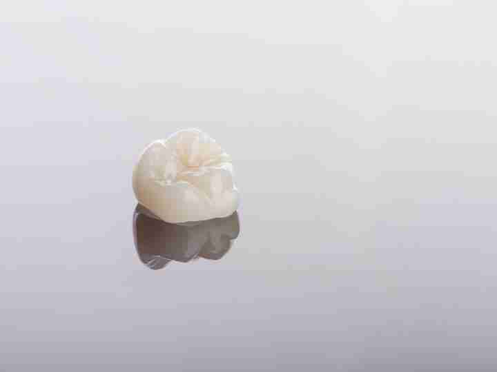 Ceramic zirconia dental crown close-up